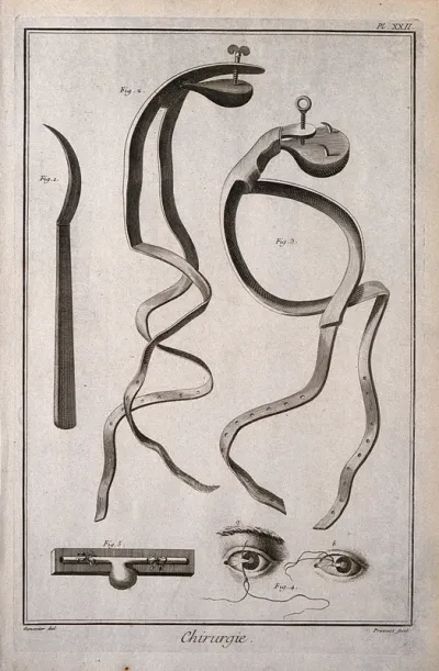 Surgery: instruments for the compression of aneurisms, including bandages