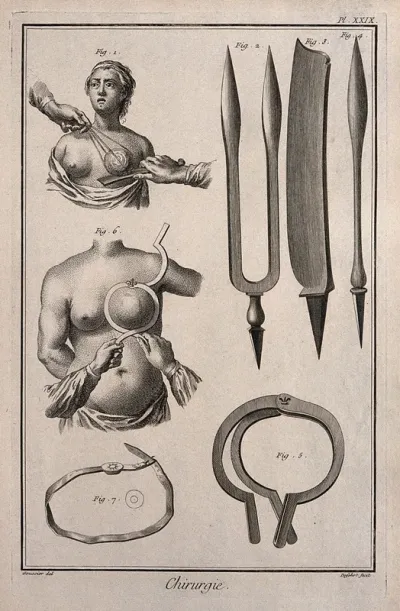 Surgery: instruments to perform a mastectomy