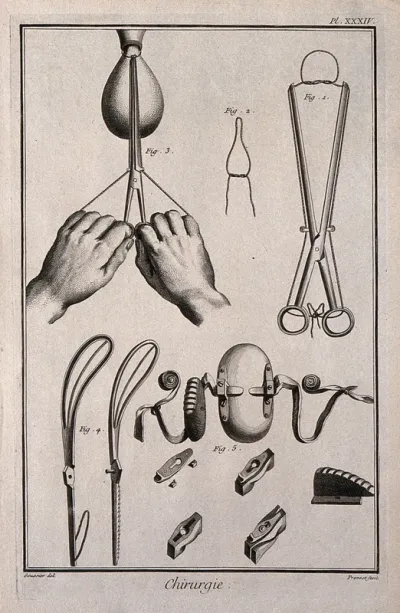 Surgery: surgical instruments for the removal of polyps from the uterus