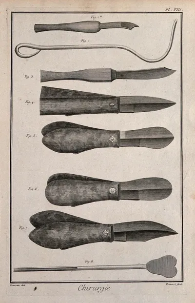 Surgery: surgical instruments for the surgical removals of stones from the urinary tract (lithotomy)