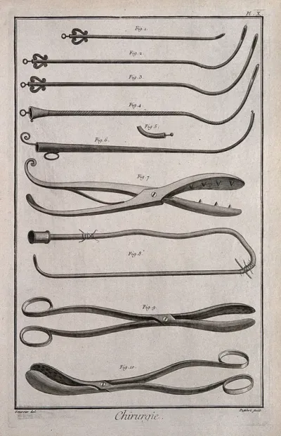Surgery: surgical instruments including a catheter and lithotomy forceps