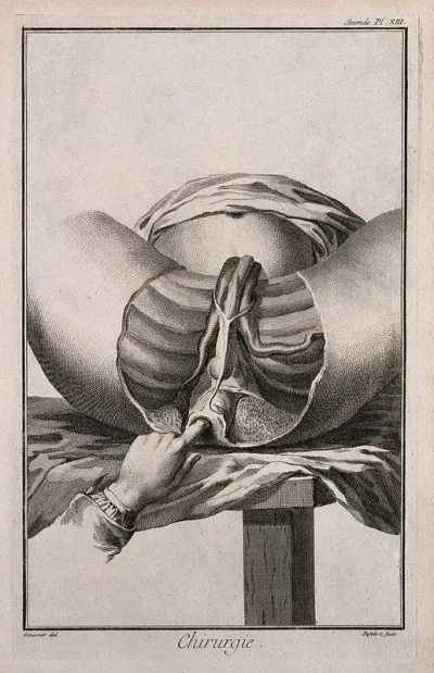 Surgery: the examination of the perineum