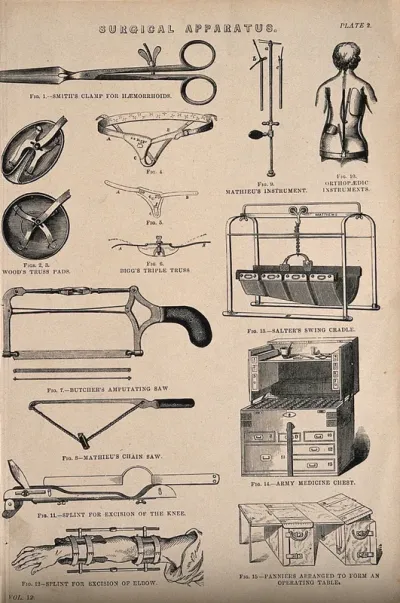 Surgical apparatus: includes an army medicine chest, demonstrations of a splint for excision of the elbow and an orthopaedic instrument to correct curvature of the spine