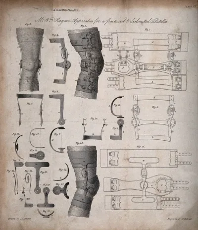 Surgical appliance for the treatment of a fractured and dislocated knee: 25 figures
