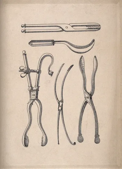 Surgical instruments: five figures, including forceps