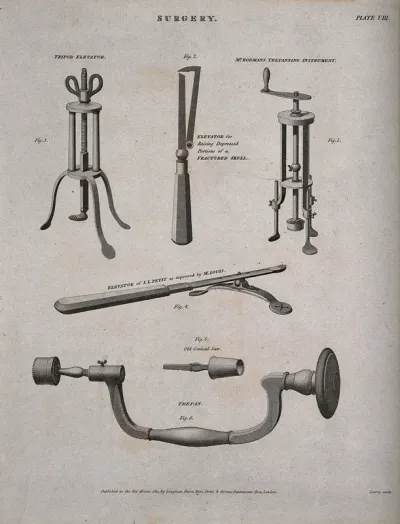 Surgical instruments for trepanning, including a tripod elevator