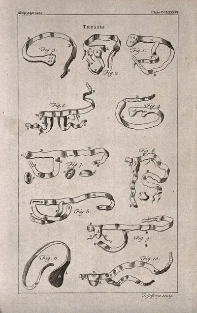 Surgical instruments: trusses