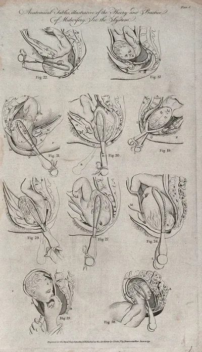 Ten diagrams illustrating various methods of delivering a baby using forceps
