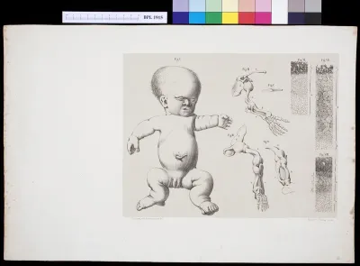 Teratology, foetus