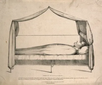 The body of Napoleon Bonaparte laid out after death, 1821