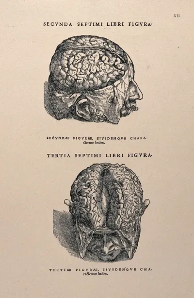 The brains of dissected heads