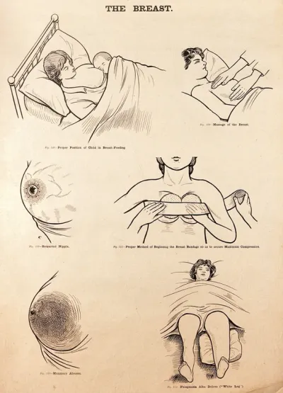The breast in childbirth