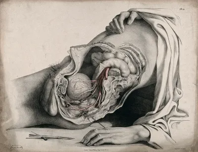 The circulatory system: dissection of the abdomen and pelvic region of a man, side view, showing the intestines and bladder, with the arteries indicated in red