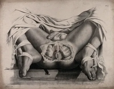 The circulatory system: dissection of the anal area of a man, with the arteries (?) indicated in red