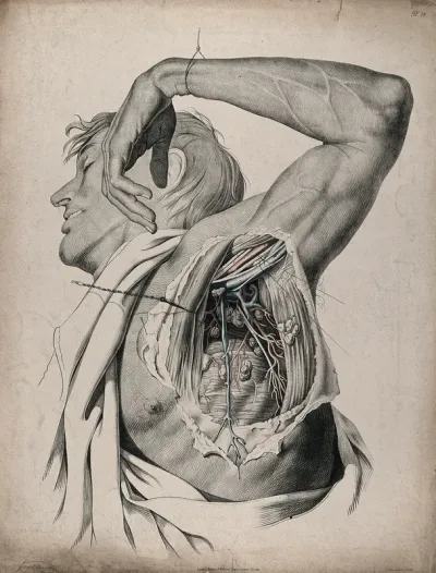 The circulatory system: dissection of the armpit of a man, showing the musculature and lymph nodes and with arteries, blood vessels and veins indicated in red and blue