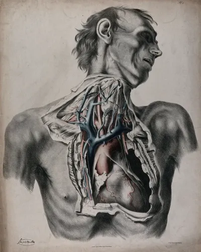 The circulatory system: dissection of the neck and thorax of a man, with aorta, arteries and veins indicated in red and blue