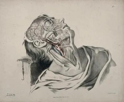 The circulatory system: dissection of the neck, face and head of a man, with arteries, blood vessels and veins indicated in red and blue