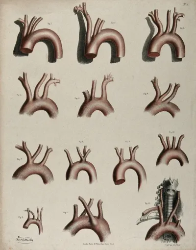 The circulatory system: dissections of the aortic arch (?), thirteen figures