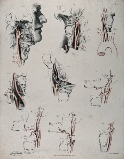 The circulatory system: dissections of the neck and jaw of a man, with arteries and blood vessels indicated in red
