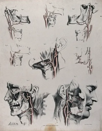 The circulatory system: dissections of the neck, jaw and face of a man, with arteries and blood vessels indicated in red