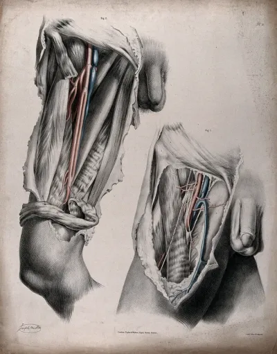 The circulatory system: dissections of the thigh and groin of a man, with the arteries and veins indicated in red and blue