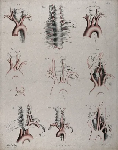 The circulatory system: dissections showing the aortic arch (?), arteries and blood vessels in relation to the spine and ribs, with arteries and blood vessels indicated in red
