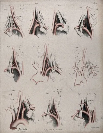 The circulatory system: dissections showing the aortic arch (?), arteries and blood vessels of the neck, with arteries and blood vessels indicated in red