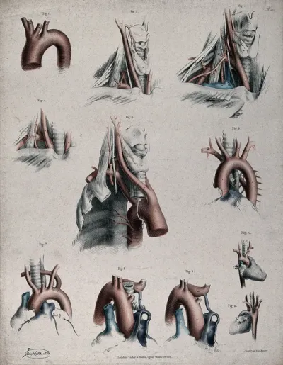 The circulatory system: dissections showing the aortic arch (?), arteries and veins of the neck, with arteries and veins indicated in red and blue