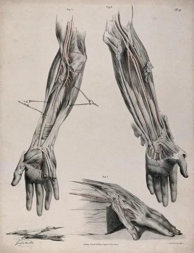 The circulatory system: three dissections of the hand and arm, with arteries and blood vessels indicated in red and surgical instruments shown beneath