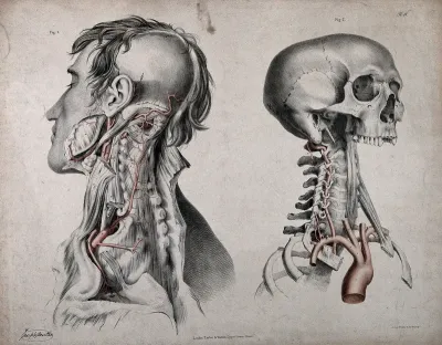 The circulatory system: two dissections of the neck, jaw and skull of a man, with aortic arch (?), arteries and blood vessels indicated in red