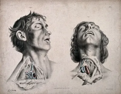 The circulatory system: two dissections of the neck of a man, with arteries, blood vessels and veins indicated in red and blue