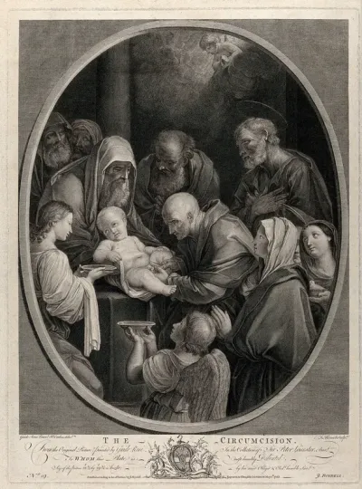 The circumcision of Christ by a bald mohel