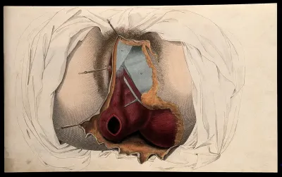 The female reproductive system: dissection of the genitalia and anus