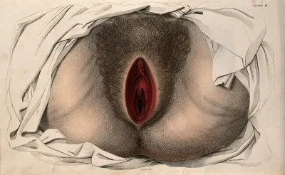 The female reproductive system, showing an external view of the genitalia