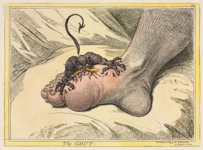The Gout