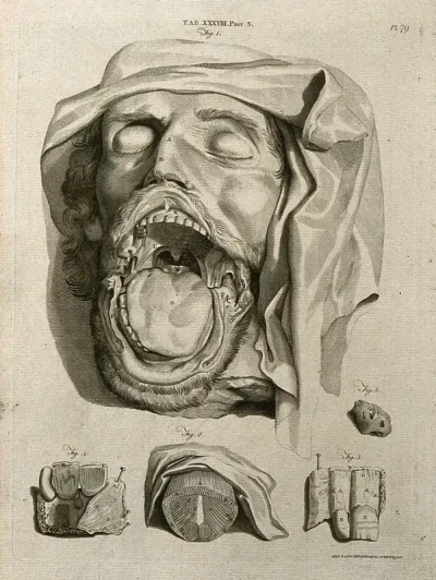 The head of a dead man with the mouth open showing interior, with details of tonsil and other parts of mouth and throat