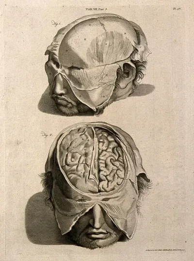 The head of a man with a moustache and beard: above, with some of the skin removed; below, showing part of the brain