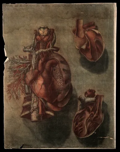 The heart: three dissections