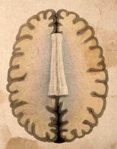 The human brain: cross-section through the hemispheres at the level of the corpus callosum