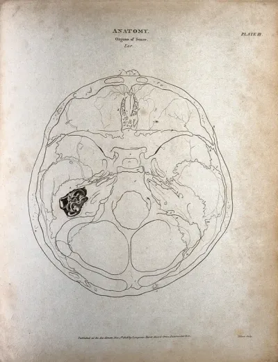The human ear: the anatomy of the inner ear, as seen through above and through the skull