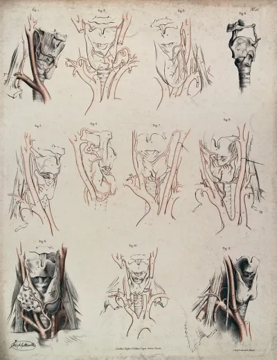 The larynx and other organs in the neck