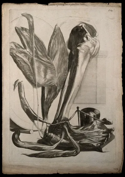 The muscles of the lower leg and the sole of the foot, dissected and separated, with the tibia and fibula exposed