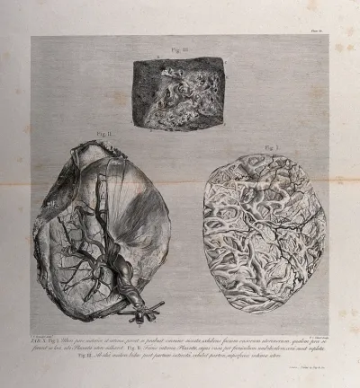 The outer forepart of the uterus, the inside of the placenta and a portion of the internal surface of the uterus: three figures