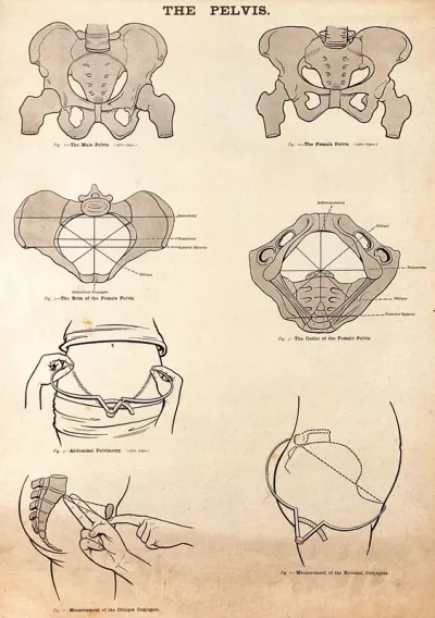 The pelvis in pregnancy