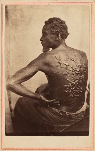 The Scourged Back