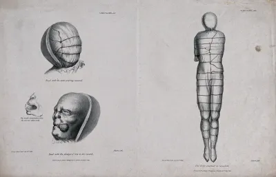 The uncovered head of a mummy: showing the head with the outer covering removed and the head with a pledget of tow in the mouth