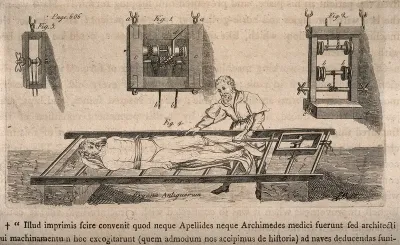 The use of the glossocoma to rejoin a dislocated joint