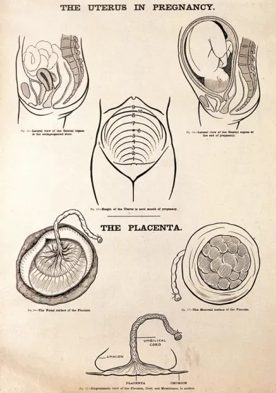 The uterus in pregnancy, and the placenta
