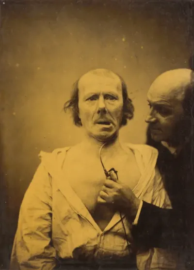 This contraction of m. platysma alone lacks expression