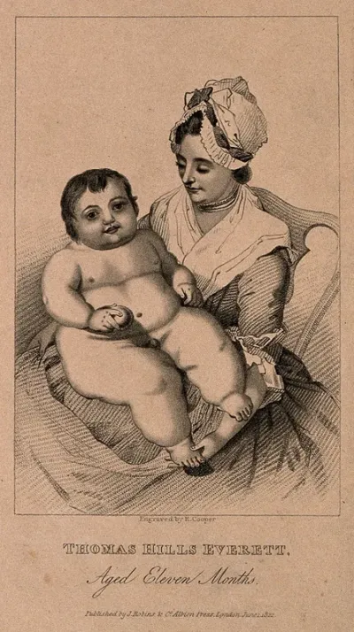 Thomas Hills Everett, an enormous infant